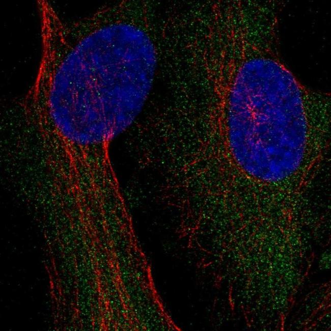 CAD Antibody in Immunocytochemistry (ICC/IF)