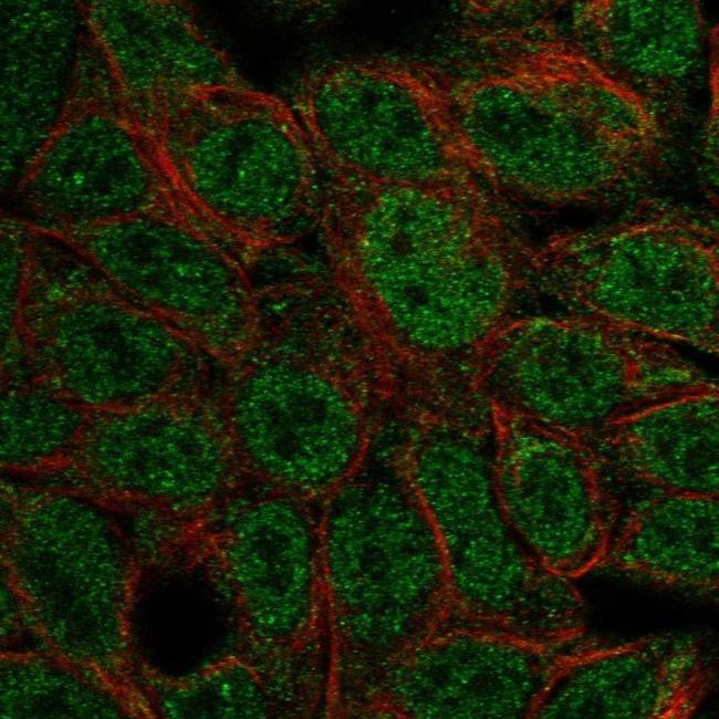 ATOH1 Antibody in Immunocytochemistry (ICC/IF)