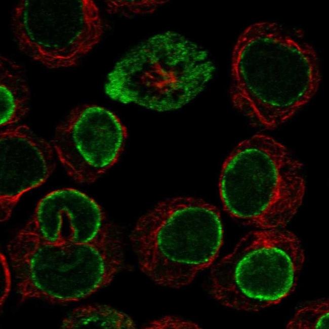 CPNE1 Antibody in Immunocytochemistry (ICC/IF)