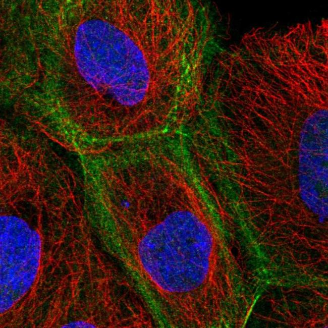 KIF3B Antibody in Immunocytochemistry (ICC/IF)