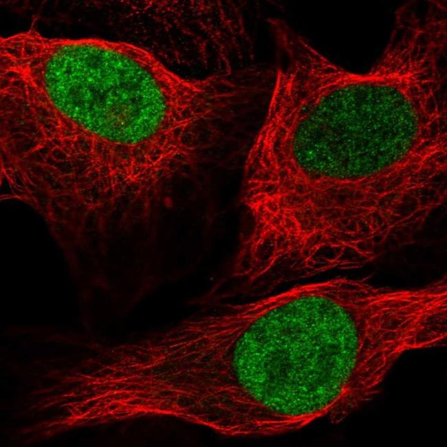 ID1 Antibody in Immunocytochemistry (ICC/IF)