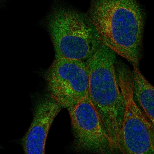 QTRTD1 Antibody in Immunocytochemistry (ICC/IF)