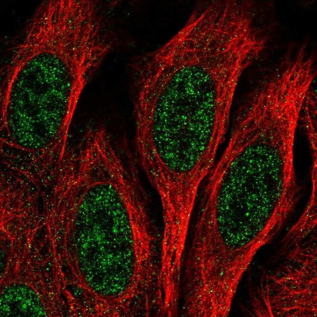 EPC1 Antibody in Immunocytochemistry (ICC/IF)