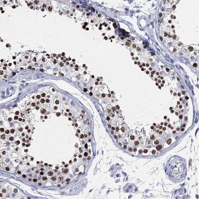 SSX1 Antibody in Immunohistochemistry (Paraffin) (IHC (P))