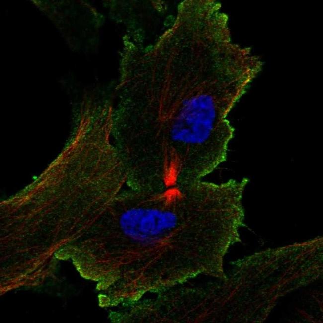 WISP2 Antibody in Immunocytochemistry (ICC/IF)