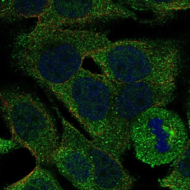 PLA2G4E Antibody in Immunocytochemistry (ICC/IF)