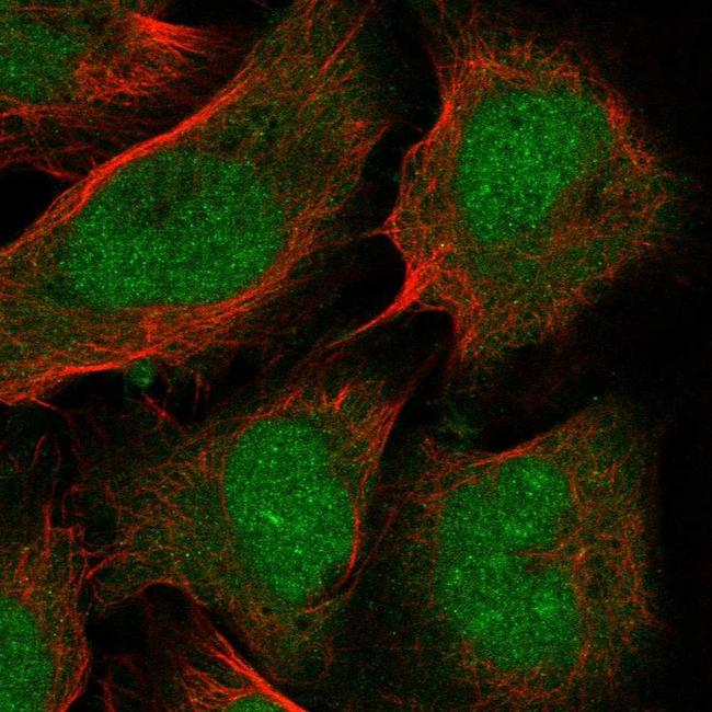 PTF1A Antibody in Immunocytochemistry (ICC/IF)