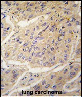 Caspase 3 Antibody in Immunohistochemistry (Paraffin) (IHC (P))