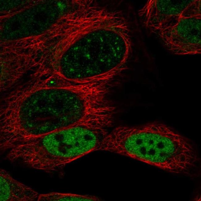 DACH1 Antibody in Immunocytochemistry (ICC/IF)