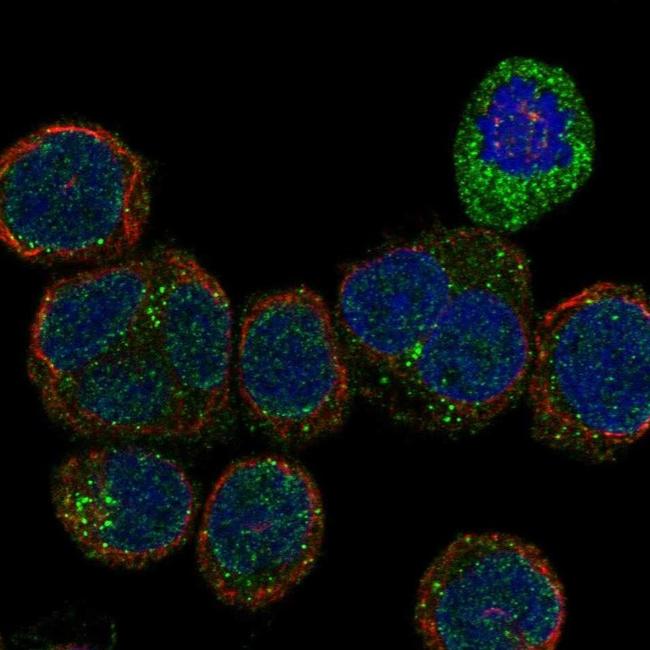 VEGF Receptor 2 Antibody in Immunocytochemistry (ICC/IF)