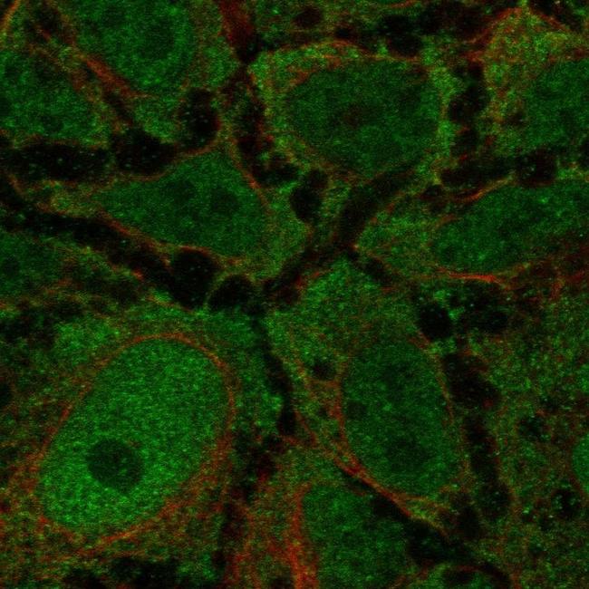 CCKAR Antibody in Immunocytochemistry (ICC/IF)