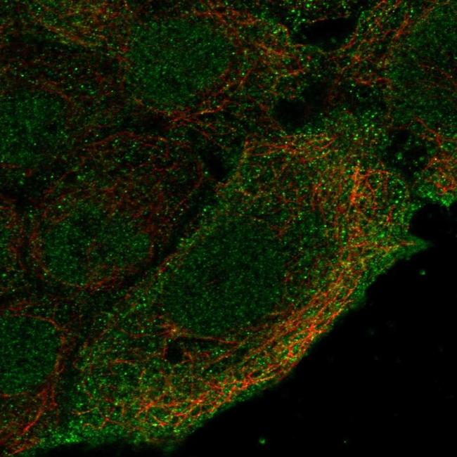 CNGA4 Antibody in Immunocytochemistry (ICC/IF)