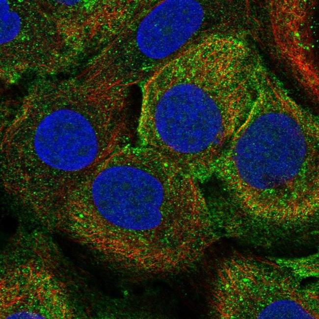 PLA2G4D Antibody in Immunocytochemistry (ICC/IF)