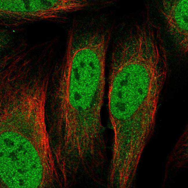 TIP60 Antibody in Immunocytochemistry (ICC/IF)