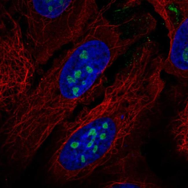 RORA Antibody in Immunocytochemistry (ICC/IF)