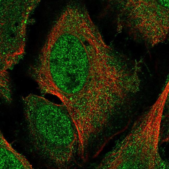 Pirin Antibody in Immunocytochemistry (ICC/IF)