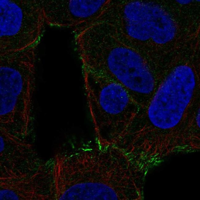 SPTLC2 Antibody in Immunocytochemistry (ICC/IF)