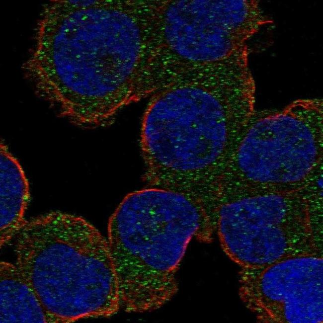 Alsin Antibody in Immunocytochemistry (ICC/IF)