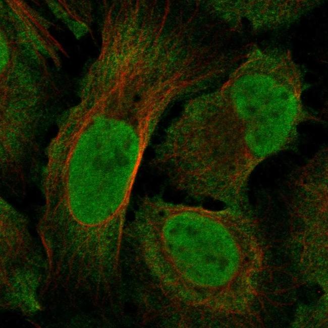 NF1 Antibody in Immunocytochemistry (ICC/IF)