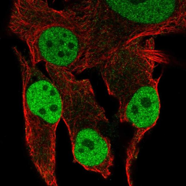 MKP2 Antibody in Immunocytochemistry (ICC/IF)