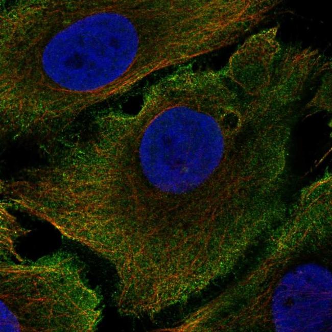 PIK3C2G Antibody in Immunocytochemistry (ICC/IF)