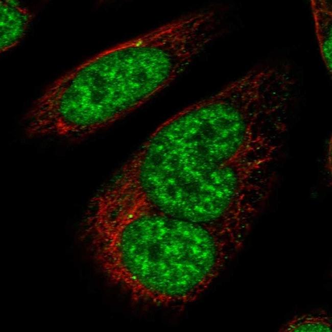 UHMK1 Antibody in Immunocytochemistry (ICC/IF)