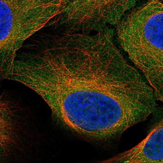 STRA8 Antibody in Immunocytochemistry (ICC/IF)