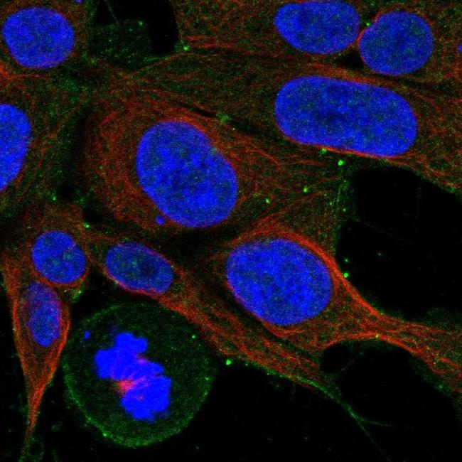 CCKBR Antibody in Immunocytochemistry (ICC/IF)