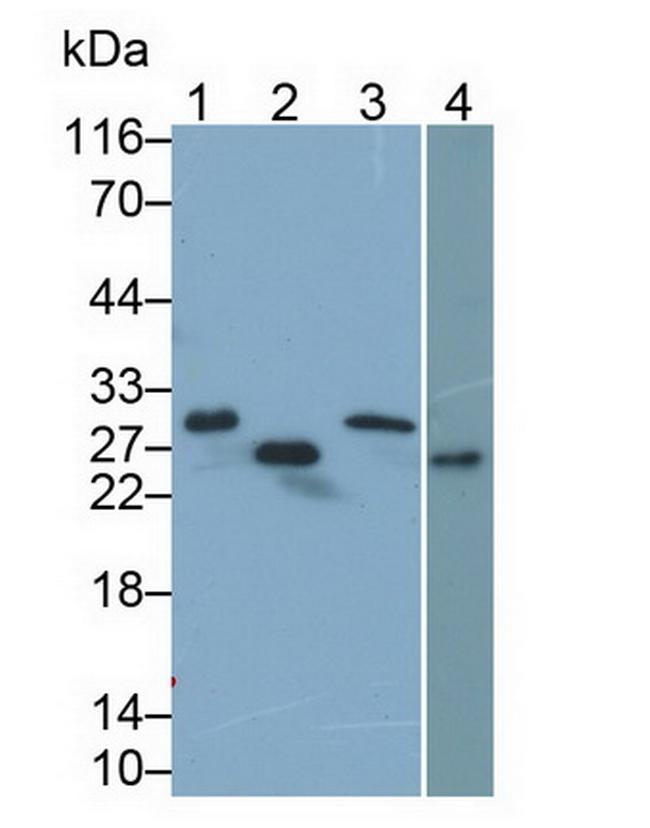 TNNI1 Antibody in Western Blot (WB)