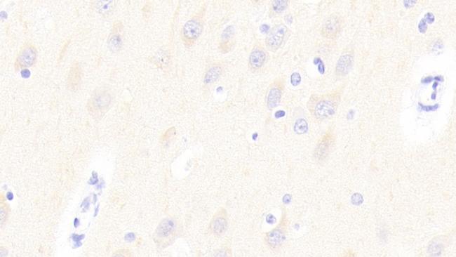 GP6 Antibody in Immunohistochemistry (Paraffin) (IHC (P))