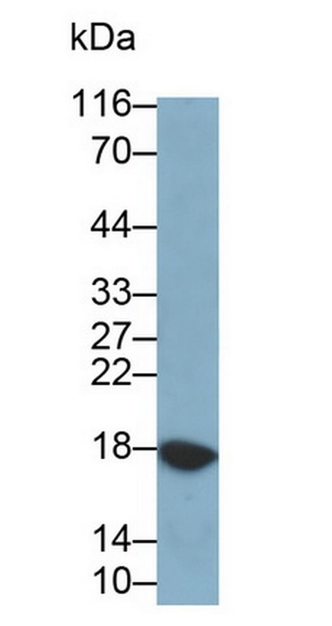 RNASE3 Antibody in Western Blot (WB)