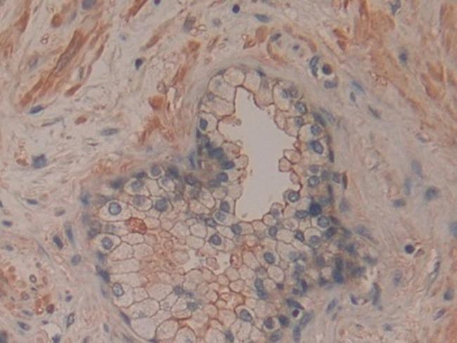 CD200 Antibody in Immunohistochemistry (Paraffin) (IHC (P))