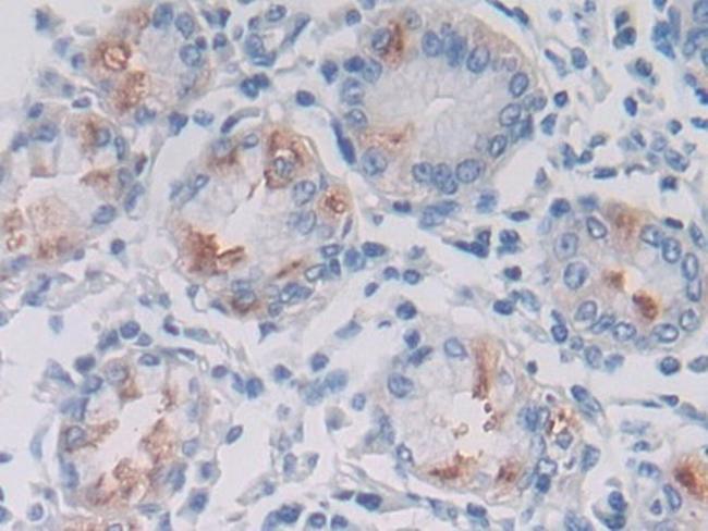 LPHN3 Antibody in Immunohistochemistry (Paraffin) (IHC (P))