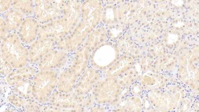 C8G Antibody in Immunohistochemistry (Paraffin) (IHC (P))