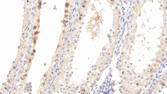 Pleiotrophin Antibody in Immunohistochemistry (Paraffin) (IHC (P))