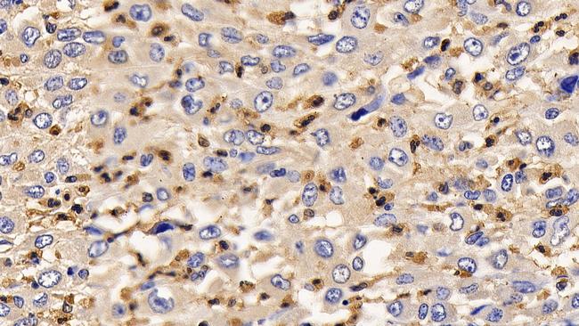 IL13RA2 Antibody in Immunohistochemistry (Paraffin) (IHC (P))