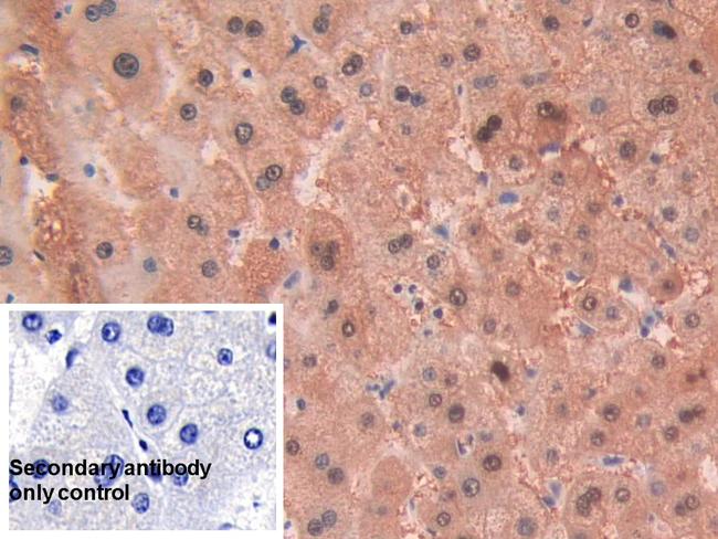 Alcohol Dehydrogenase 1A Antibody in Immunohistochemistry (Paraffin) (IHC (P))