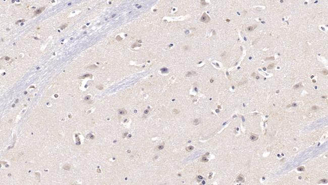 KPNA3 Antibody in Immunohistochemistry (Paraffin) (IHC (P))