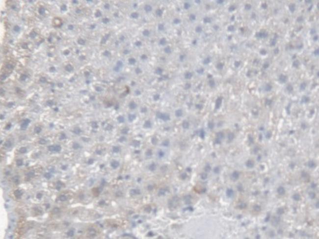 CES1 Antibody in Immunohistochemistry (Paraffin) (IHC (P))