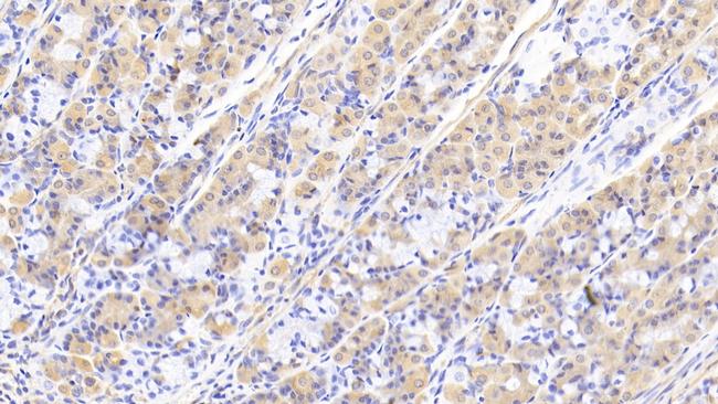 PEX1 Antibody in Immunohistochemistry (Paraffin) (IHC (P))