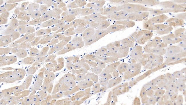 SEMA5B Antibody in Immunohistochemistry (Paraffin) (IHC (P))