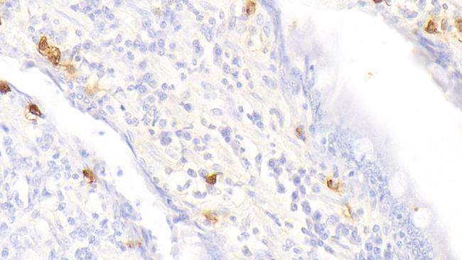 Tryptase Antibody in Immunohistochemistry (Paraffin) (IHC (P))