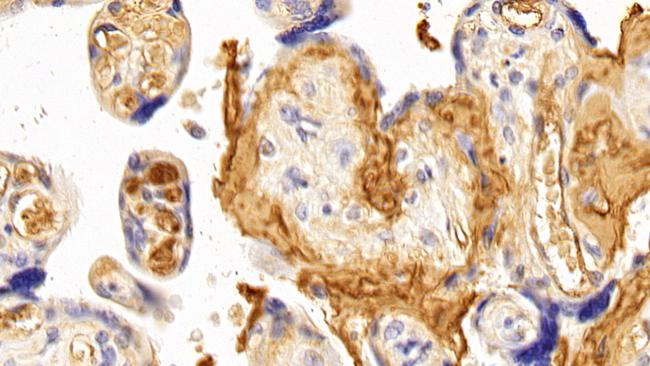 Fibrinogen Antibody in Immunohistochemistry (Paraffin) (IHC (P))