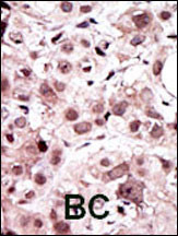 Axl Antibody in Immunohistochemistry (Paraffin) (IHC (P))