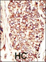 ErbB2 (HER-2) Antibody in Immunohistochemistry (Paraffin) (IHC (P))