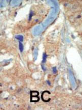 FLT3 Antibody in Immunohistochemistry (Paraffin) (IHC (P))