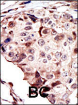 RYK Antibody in Immunohistochemistry (Paraffin) (IHC (P))