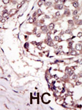 RYK Antibody in Immunohistochemistry (Paraffin) (IHC (P))