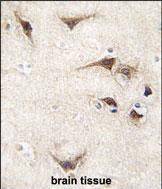 TYRO3 Antibody in Immunohistochemistry (Paraffin) (IHC (P))