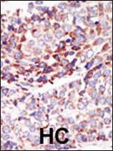 TEK Antibody in Immunohistochemistry (Paraffin) (IHC (P))